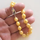  Preview image for 10.5 MM - 13 MM POTATO SHAPE YELLOW 