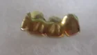  Preview image for 18k Gold Dental Bridge 